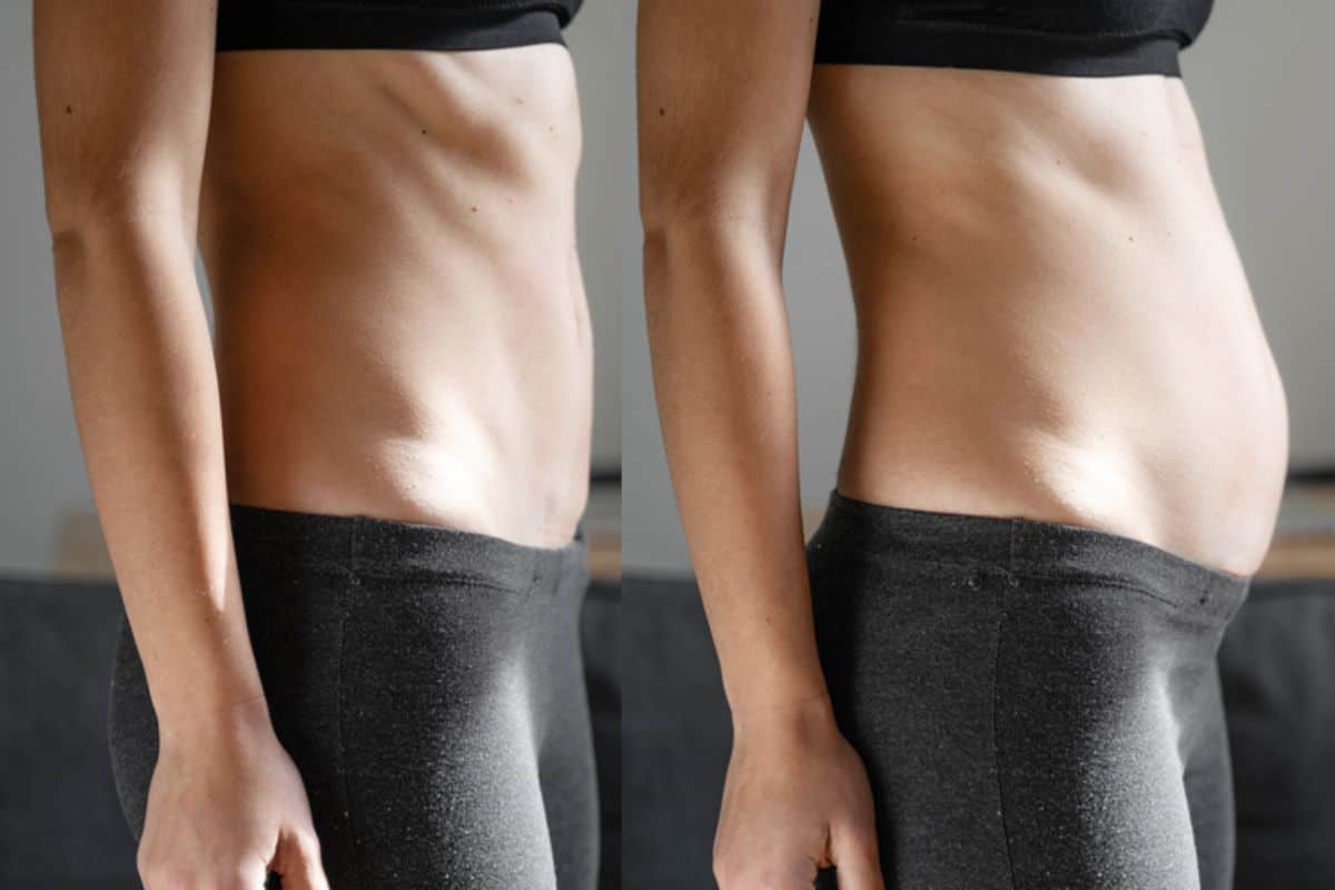 How long does diastasis recti take to improve Rugby?