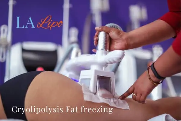 women getting fat freezing Rugby