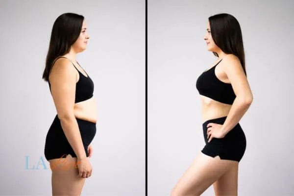 link between body image and mental health Rugby