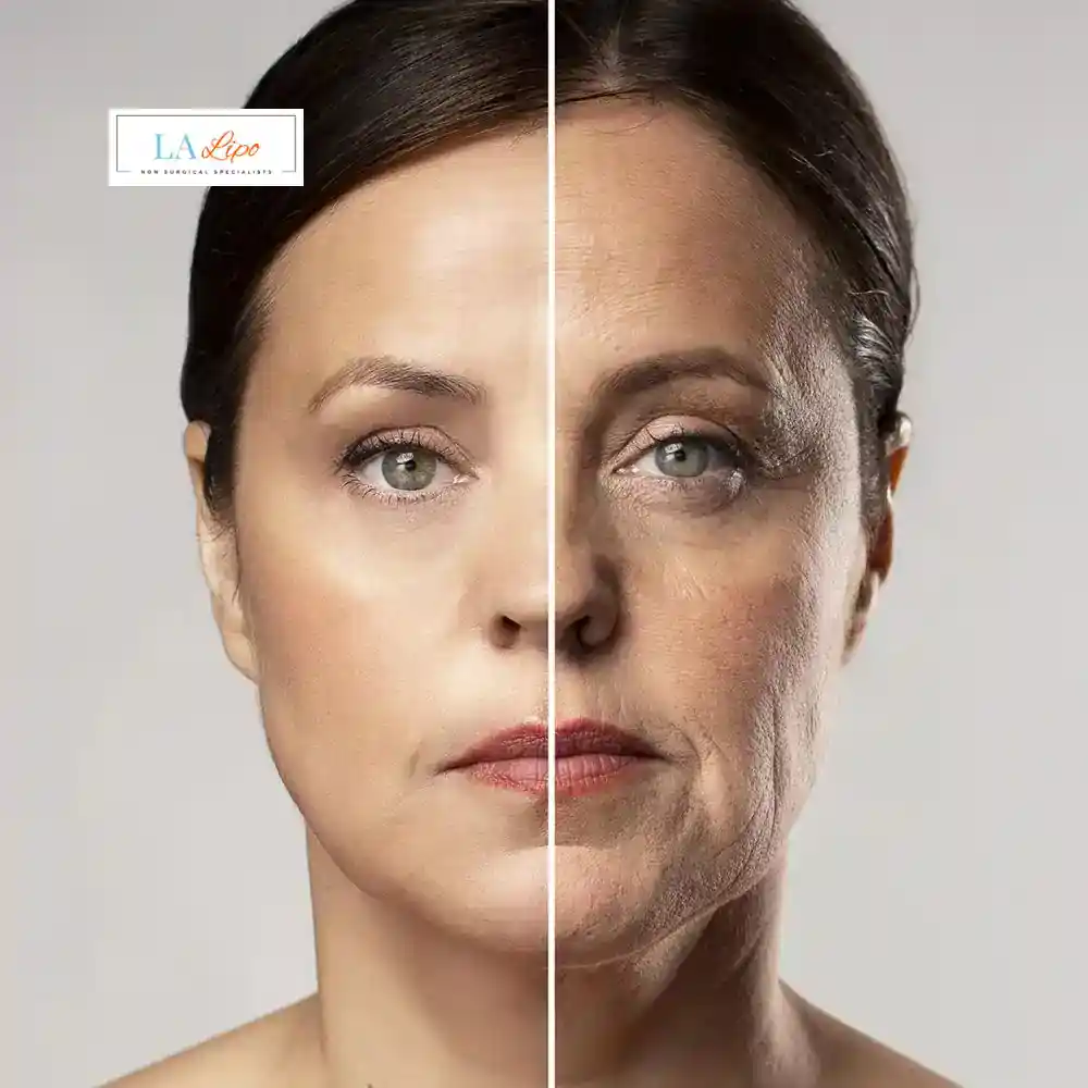 How Can You Tell If Non-Surgical Skin Tightening Is Right for You Rugby?