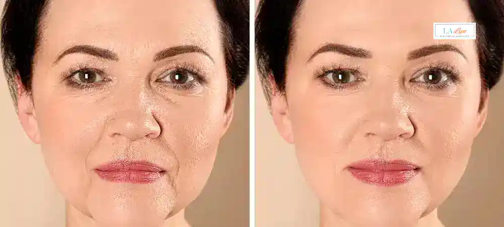 Why Aren’t My Skincare Products Making My Sagging Skin Look Firmer Rugby?