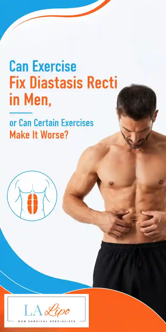 Can Exercise Fix Diastasis Recti in Men, or Can Certain Exercises Make It Worse Rugby?